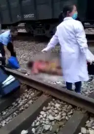 重庆男子想当网红爬火车拍抖音,惨被高压电烧伤,你怎么看
