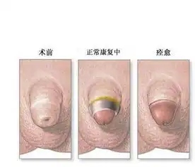 泌尿外科百科泌尿外科医学疾病文章列表,第200页快速问医生
