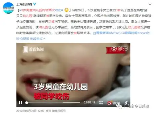 气愤深圳女童被男同学勒脖咬伤面部早教机构拟和解书逃避责任
