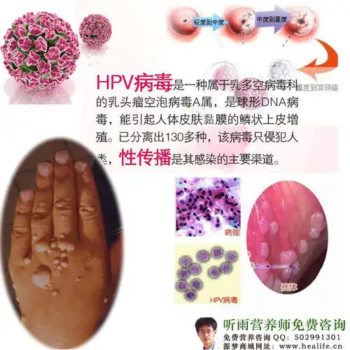 hpv高危阳性可以投保吗hpv阳性还能买重疾险么
